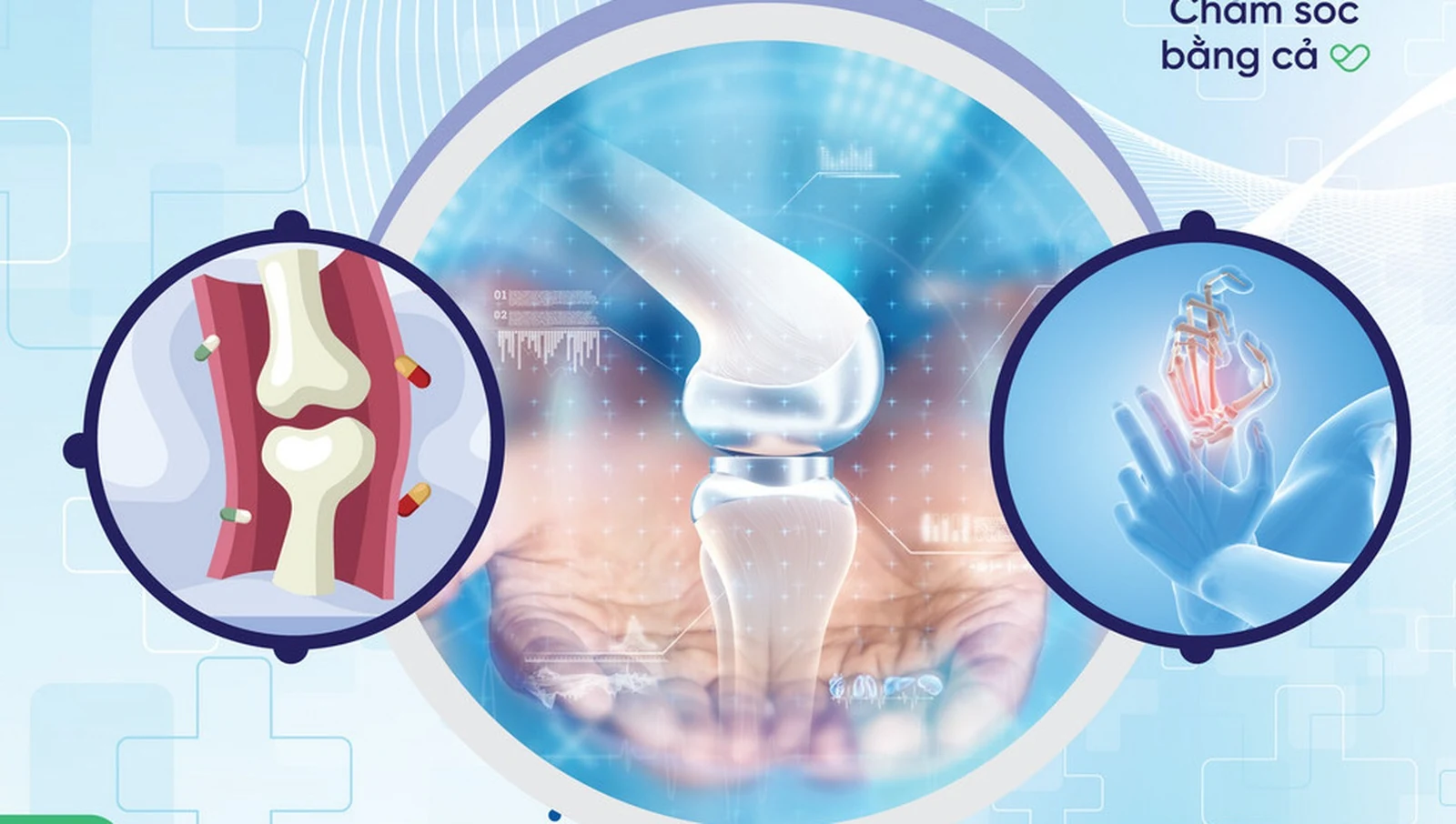 정형외과 - Bệnh viện Đa khoa Quốc tế Sante