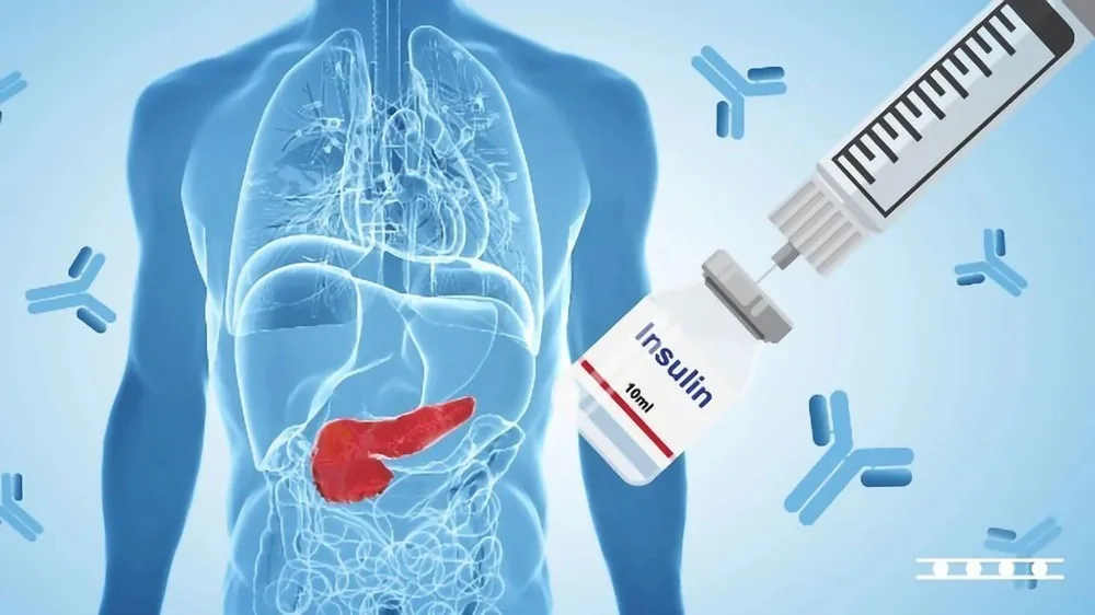 Đái tháo đường tác nhân "Thầm lặng" gây ra bệnh thận mạn - Hình 3 - Bệnh viện SANTE Bình Thạnh, TP.HCM
