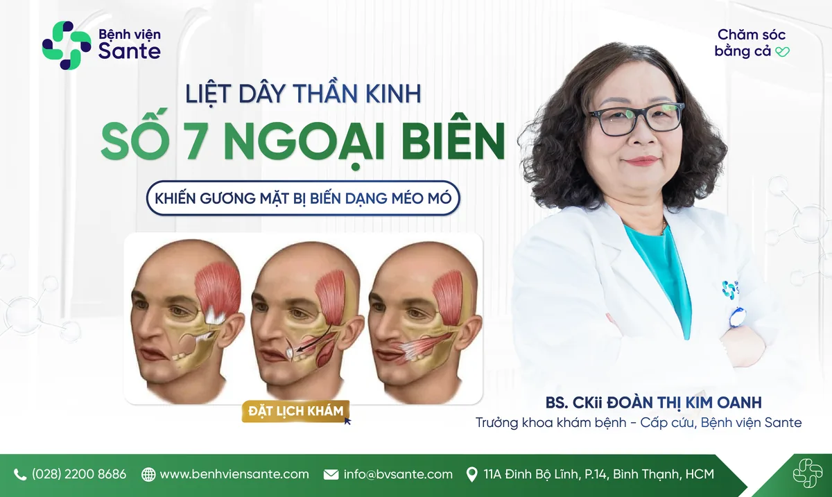 말초성 안면신경마비(벨마비), 안면 변형을 유발하는 질환 - 산테(SANTE) 병원 빈탄, 호치민시