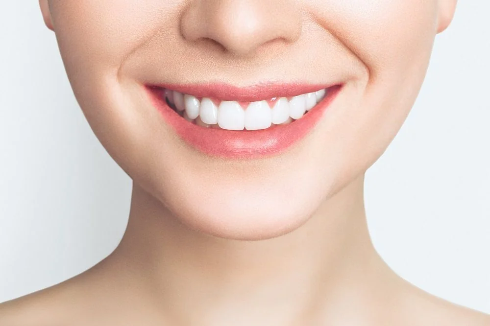 Bệnh viện Sante - Veneer sứ (mặt dán sứ) (Hình 3) Bệnh viện Sante - Veneer sứ (mặt dán sứ) (Hình 3)
