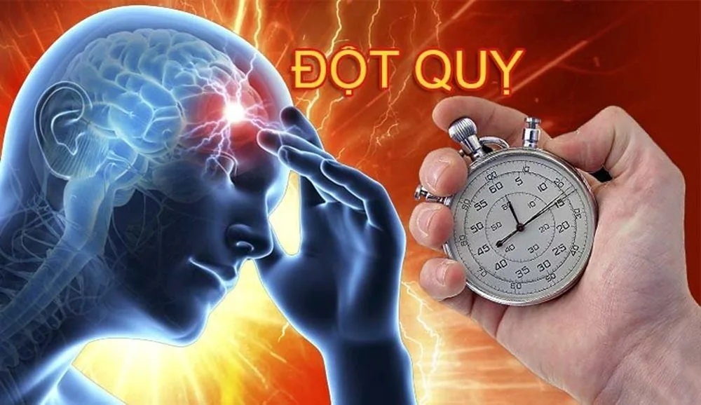 Đột quỵ và Stress: Những câu hỏi thường gặp - Hình 2 - Bệnh viện SANTE Bình Thạnh, TP.HCM