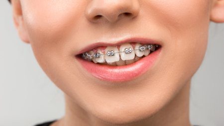 Thẩm mỹ răng, thẩm mỹ nha chu, thẩm mỹ hàm mặt, chỉnh nha